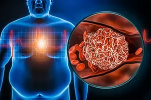 Cardiovascular Diseases CT08 copy